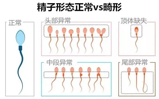 試管嬰兒想要胚胎健康發(fā)育，精子質(zhì)量不能忽視！