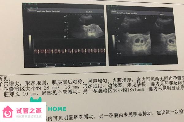 別再問(wèn)泰國(guó)試管做一對(duì)龍鳳胎需要多少錢(qián)，費(fèi)用明細(xì)看這里