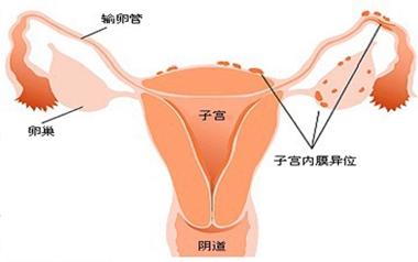 做試管嬰兒的流程及基本要求