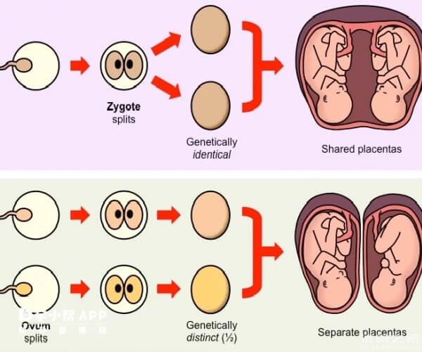 揭秘同*雙胞胎是如何形成的，對比異*雙胞胎區(qū)別有三種