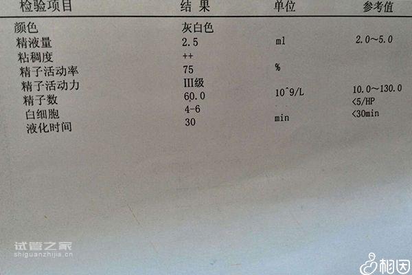 南京精子檢查哪家醫(yī)院好過來人有話說，玄武這家別錯(cuò)過