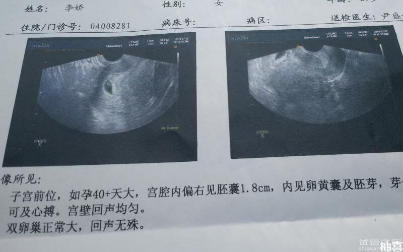 測(cè)生男生女的方法比比皆是，真正科學(xué)的就兩個(gè)