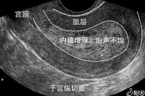 安蘇萌可否促卵泡發(fā)育、幫助內(nèi)膜生長剖析，看完就明了