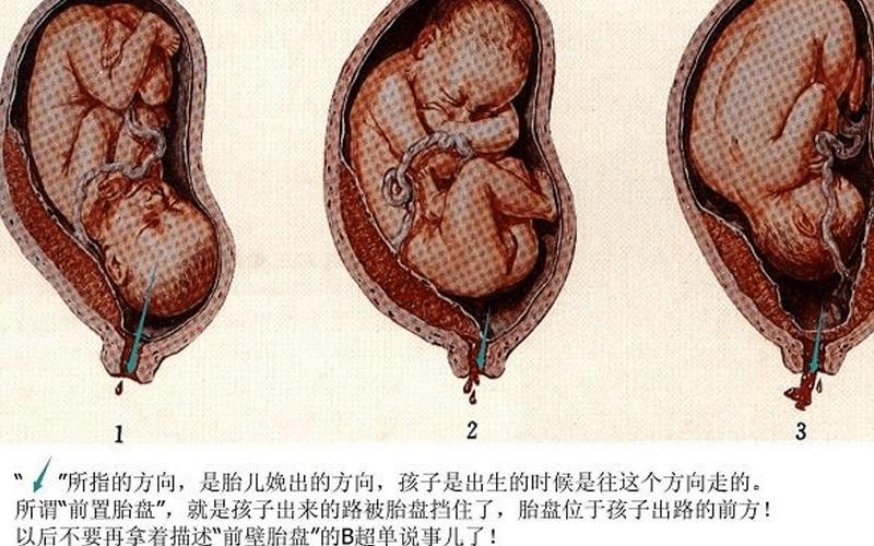 孕婦別忽視羊水深度超標(biāo)的危害，對寶寶有這4大影響！