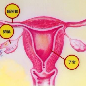 巧克力囊腫的3年試管嬰兒全部經(jīng)歷—明細(xì)到每個(gè)時(shí)間點(diǎn)的感受