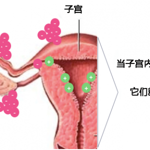 子宮內(nèi)膜異位癥治療后會復(fù)發(fā)嗎？治療后是自然懷孕還是做試管嬰兒好？ 