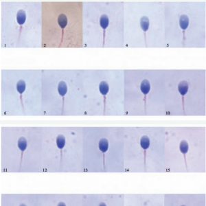 什么樣才算正常精子形態(tài)？異常精子和正常精子都是長什么樣子的？ 