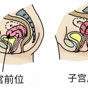 子宮前位和后位那種更容易受孕？