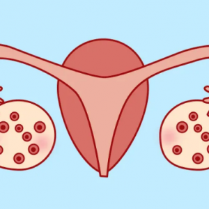 揭秘：多囊*巢綜合征對試管嬰兒成功率到底有多大影響？