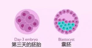 試管嬰兒移植囊胚還是鮮胚呢？