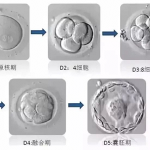 試管嬰兒移植：凍胚、鮮胚、囊胚、應(yīng)如何選擇？