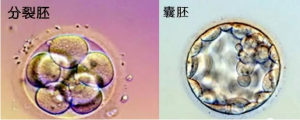 試管嬰兒移植鮮胚、凍胚、囊胚？我符合哪個(gè)條件？