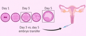 試管嬰兒鮮胚、凍胚、囊胚，應(yīng)該如何選擇？